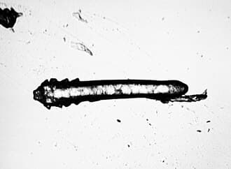 Microscopic image of Demodex folliculorum mite.
